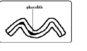 phacolith312420191104.png